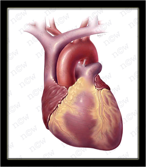 Heart (Nicole Wolf)