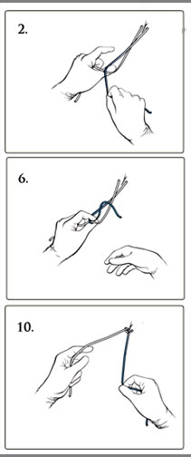 Suturing Technique Detail (Nicole Wolf)